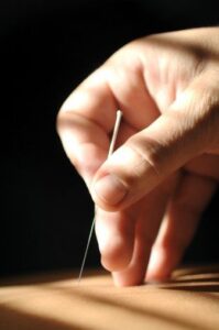 طب سوزنی